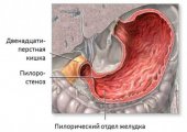 Особенности строения пилорического отдела желудка