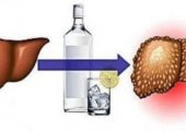 Способы лечения алкогольного поражения печени