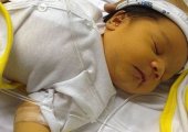 Симптомы и лечение конъюгационной желтухи у новорожденных