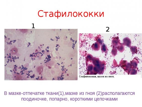 инфекции под микроскопом