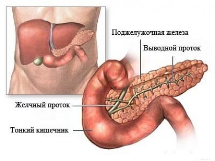 Геморрагическая форма острого панкреатита thumbnail