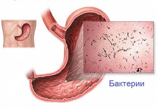 бактерии в желудке